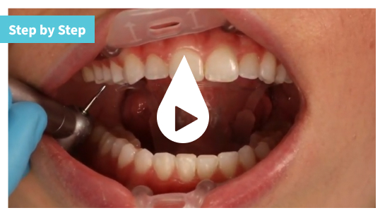 step-by-step-video