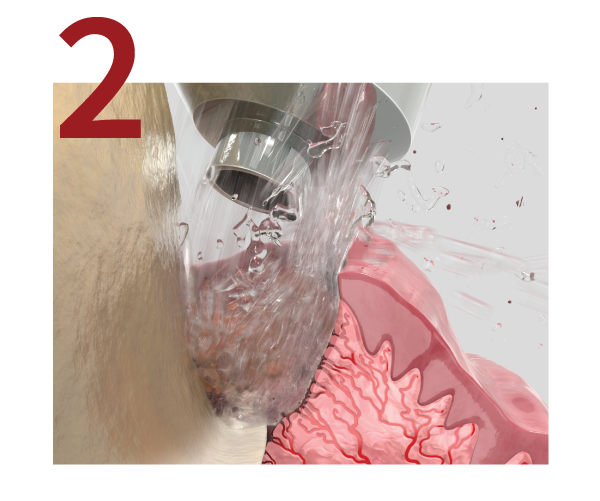 burnishing step2
