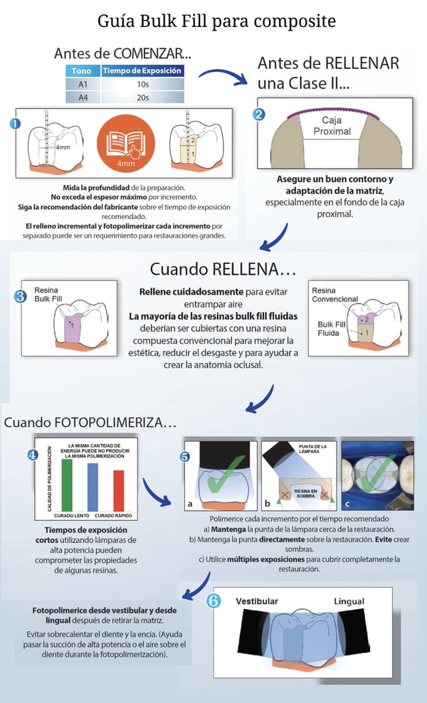 GUIA-bulk-fill-composite