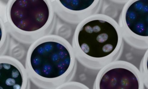 Tipos de cáncer poco comunes: ¿cómo se pueden detectar?