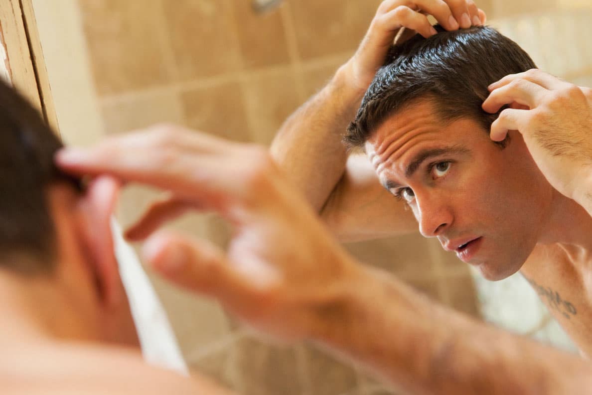 Man looking at hairline in mirror