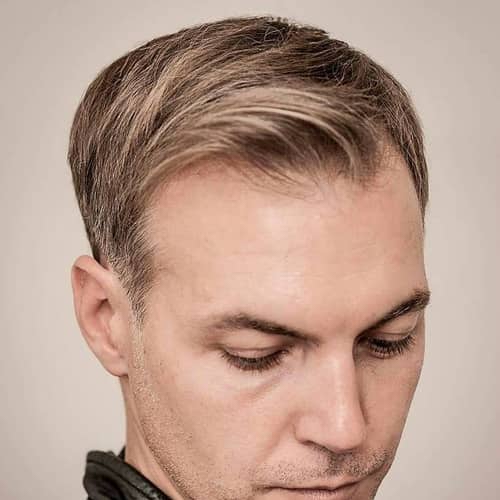 15 Trending Hairstyles for Balding Men (Top, Front & Sides)