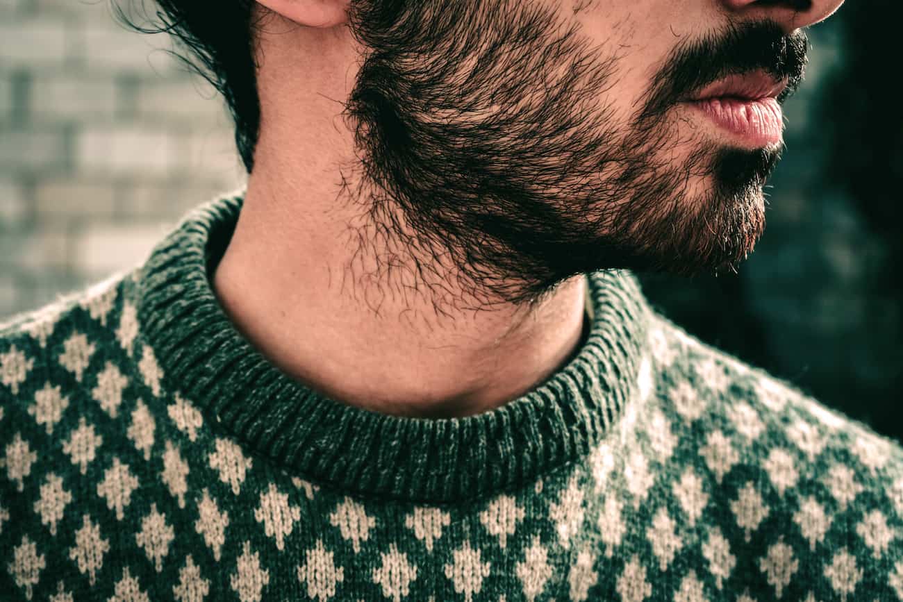 Does your ability to grow a beard cause hair loss? | Mosh