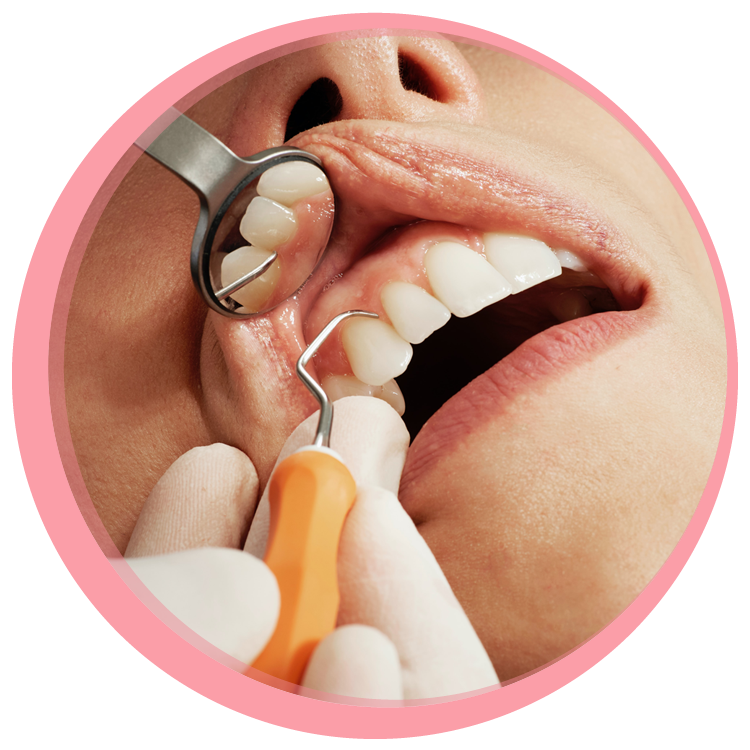 What is periodontitis? And how to prevent it.