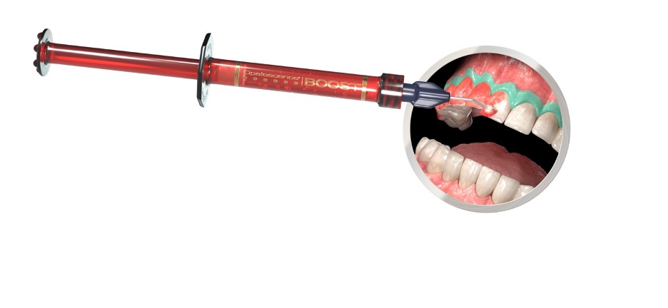 Application of Boost with syringe