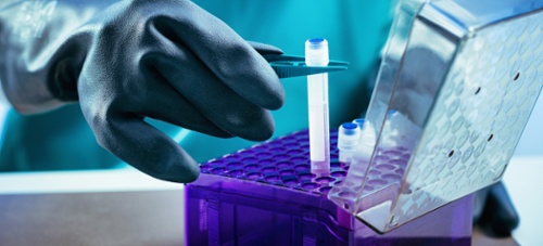 Biobanking Clinical Research LabWare-1