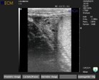  Image 10, testis scan using the ExaGo