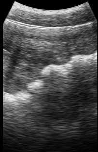 Image 3, non-pregnant sow 21 days post AI detected using the Duo-Scan:Go Plus