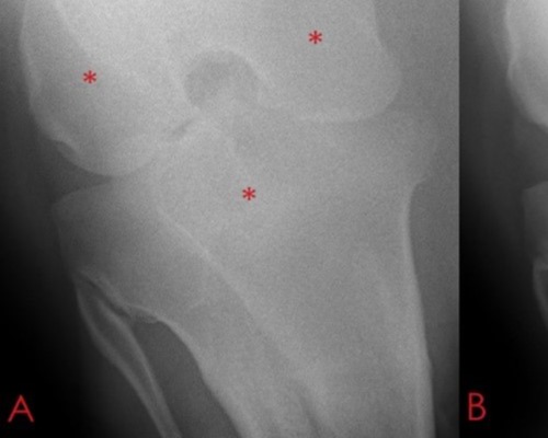 5 ways to improve your equine X-ray image